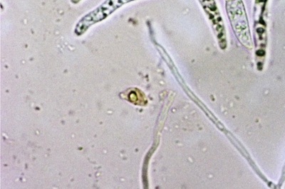 mycogloea-macrospora5