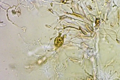 myxarium-nucleatum10