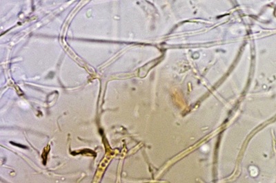 myxarium-nucleatum12