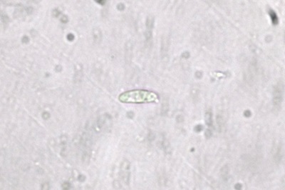 neofavolus-alveolaris3