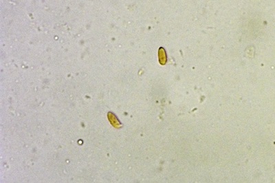 neolentinus-adhaerens10