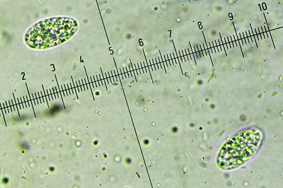 paragalactinia-succosa2