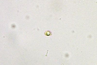 phaeolus-schweinitzii11