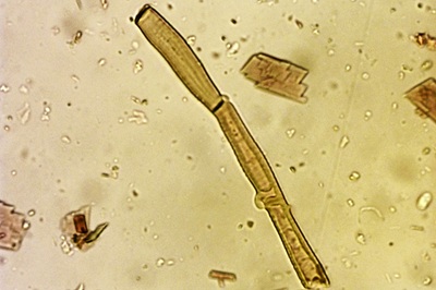 phaeomarasmius-erinaceus10