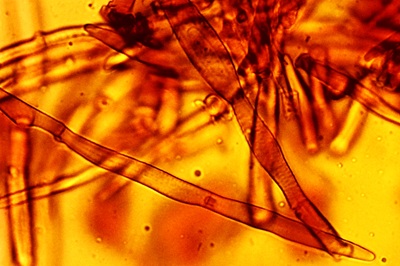 phaeomarasmius-erinaceus12