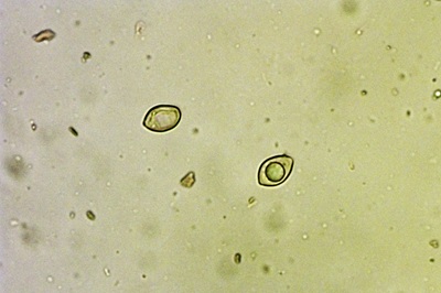 phaeomarasmius-erinaceus8