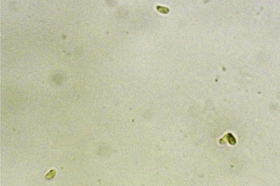 phlebia-rufa11