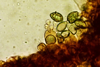 phlegmacium-triumphans10