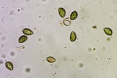 phlegmacium-triumphans9