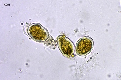 phragmidium-mucronatum3