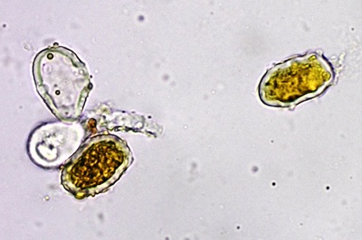 phragmidium-mucronatum4