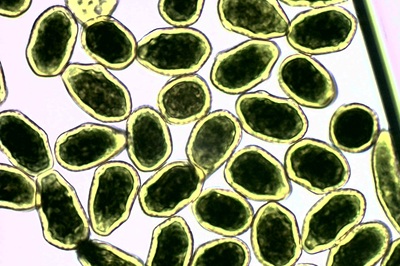 phragmidium-mucronatum6