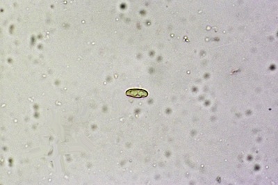 phylloporus-pelletieri8