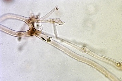 pleurotus-ostreatus9