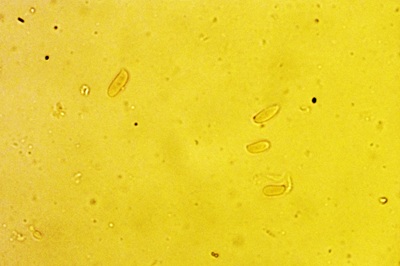 pleurotus-pulmonarius5
