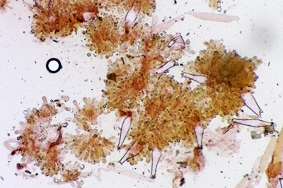 pluteus-petasatus11