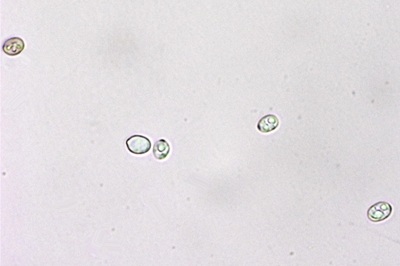 pluteus-petasatus7