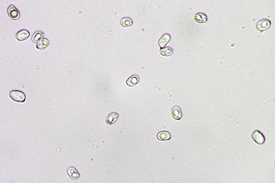 pluteus-petasatus8