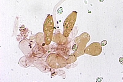 pluteus-petasatus9