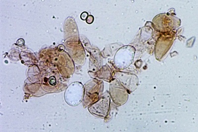pluteus-variabilicolor10