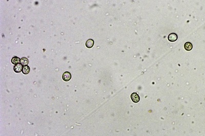pluteus-variabilicolor7