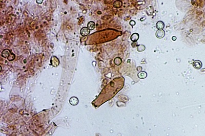 pluteus-variabilicolor9