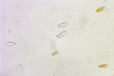 polyporus-tuberaster9