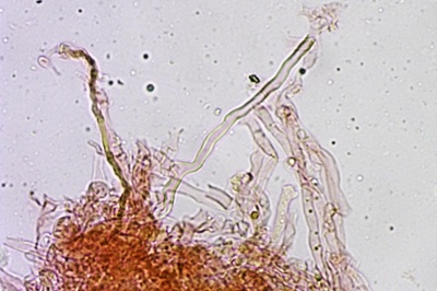 polyporus-umbellatus10