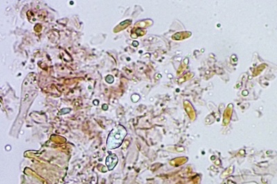 polyporus-umbellatus7