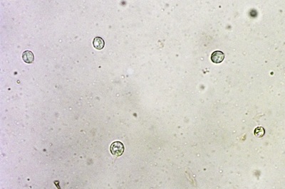 pseudohydnum-gelatinosum10