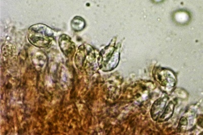 pseudohydnum-gelatinosum11