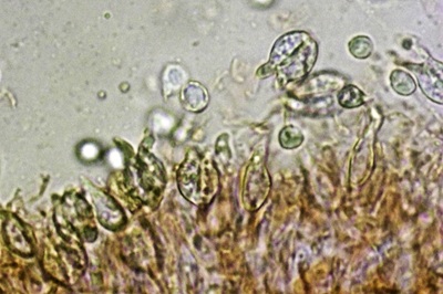 pseudohydnum-gelatinosum12