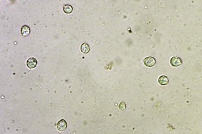 pseudohydnum-gelatinosum9