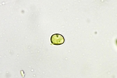 pseudoporpoloma-pes-caprae1