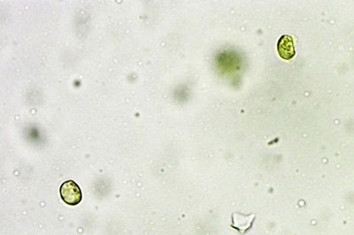 pseudoporpoloma-pes-caprae2