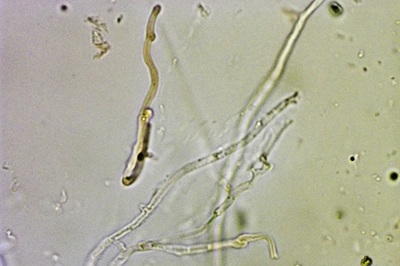 resupinatus-applicatus12