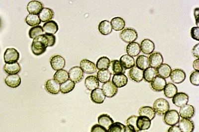 reticularia-lycoperdon10