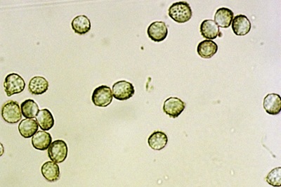 reticularia-lycoperdon9