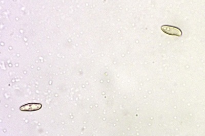 rubroboletus-rhodoxanthus6