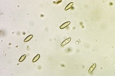 rubroboletus-rhodoxanthus7
