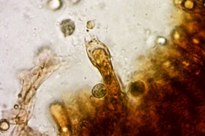 russula-atropurpurea10