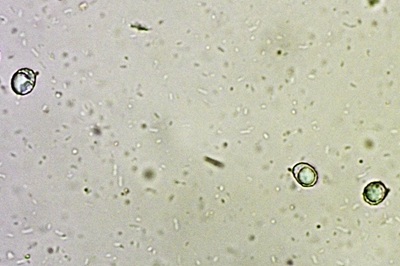 russula-atropurpurea8