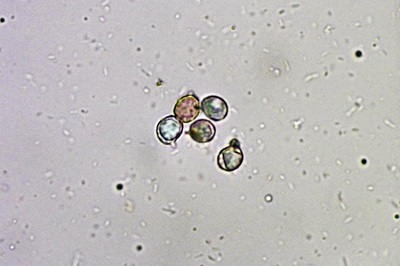 russula-atropurpurea9