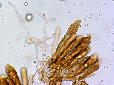 russula-cyanoxantha-f-cutefracta10