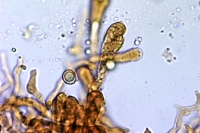 russula-cyanoxantha-f-cutefracta11