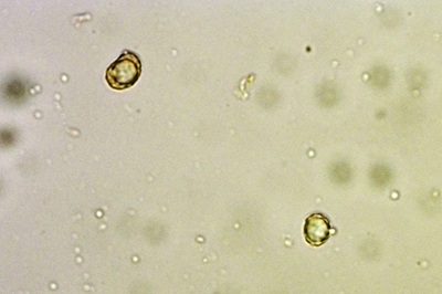 russula-cyanoxantha-f-cutefracta7