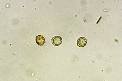 russula-subfoetens7