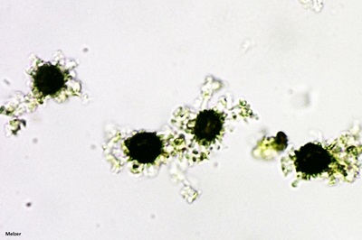 scleroderma-citrinum5