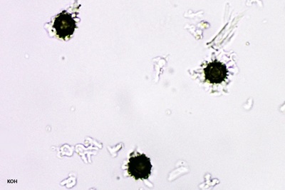 scleroderma-citrinum6