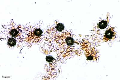 scleroderma-citrinum7